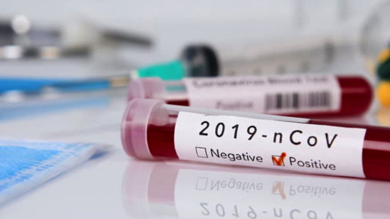 Coronavirus: Contagios por Covid-19 en el mundo superan 1.2 millones de casos