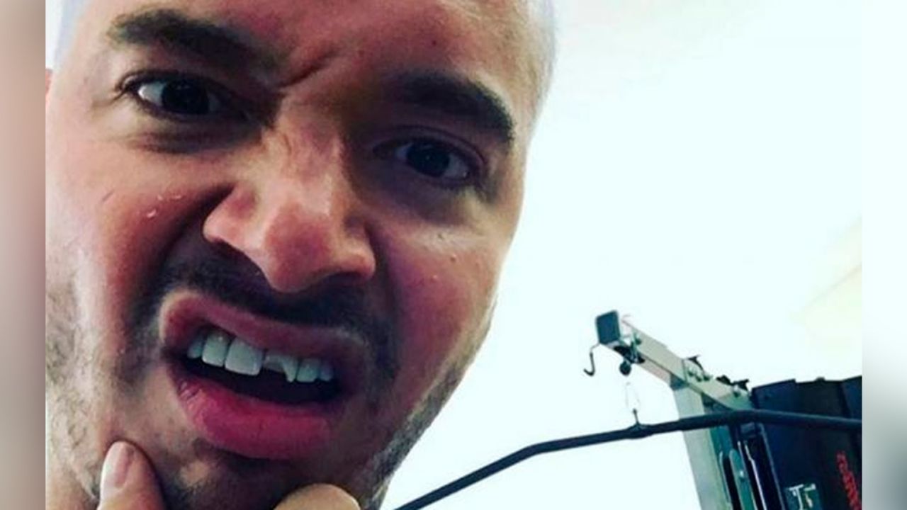 J Balvin es ‘destrozado’ en Instagram por burlarse de los tartamudos