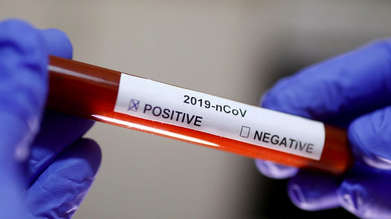 Coronavirus en Colombia: Ya suman 780 casos por Covid-19 y 50 muertes