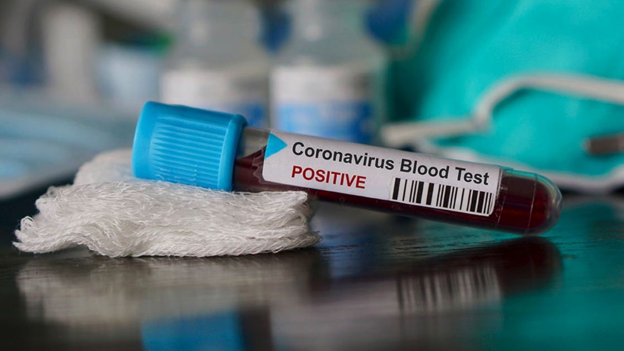 Rusia registra más de 8 mil contagios por Covid-19; Moscú es el más afectado