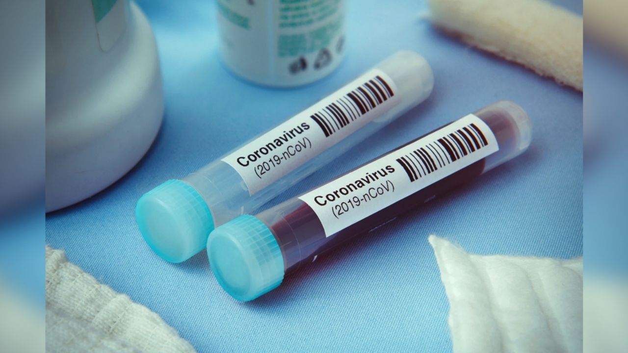 Coronavirus: EU tiene 451 mil 491 contagios; NY es el estado con más casos