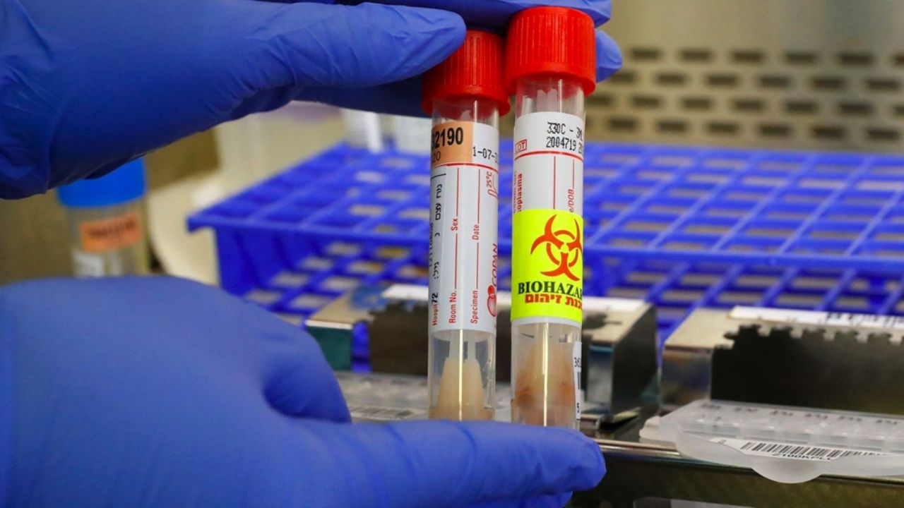 Irán ya supera los 4 mil muertos por Covid-19; hay más de 66 mil enfermos