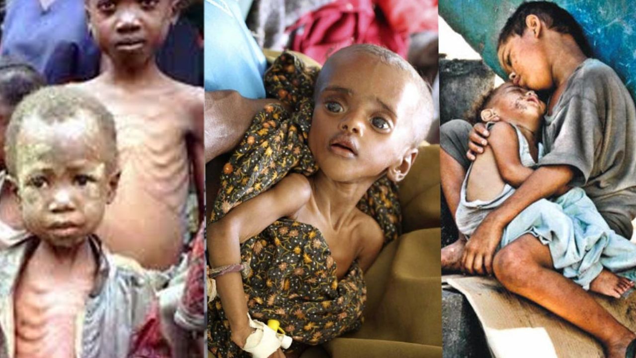 “El virus del hambre mata a 8500 niños pero no sale en TV porque no mata a ricos”, acusan en redes
