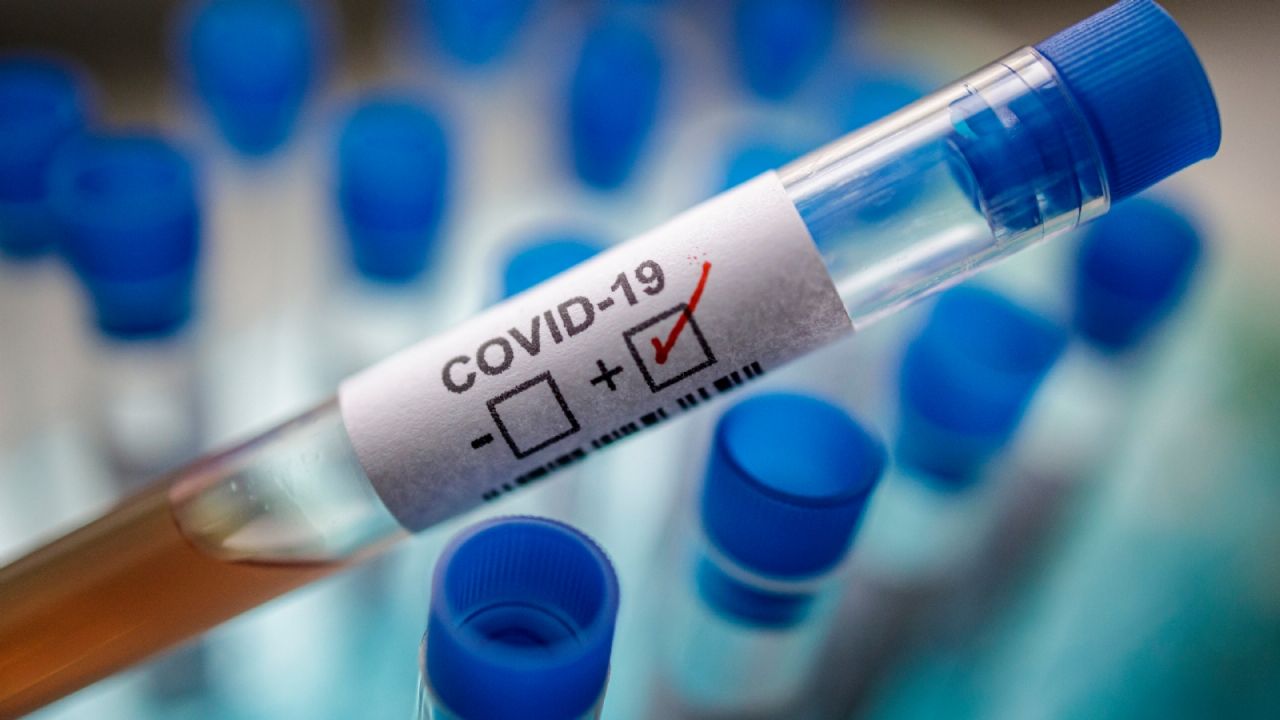 Coronavirus: La pandemia ya cobra la vida de 135 mil 163 personas en el mundo