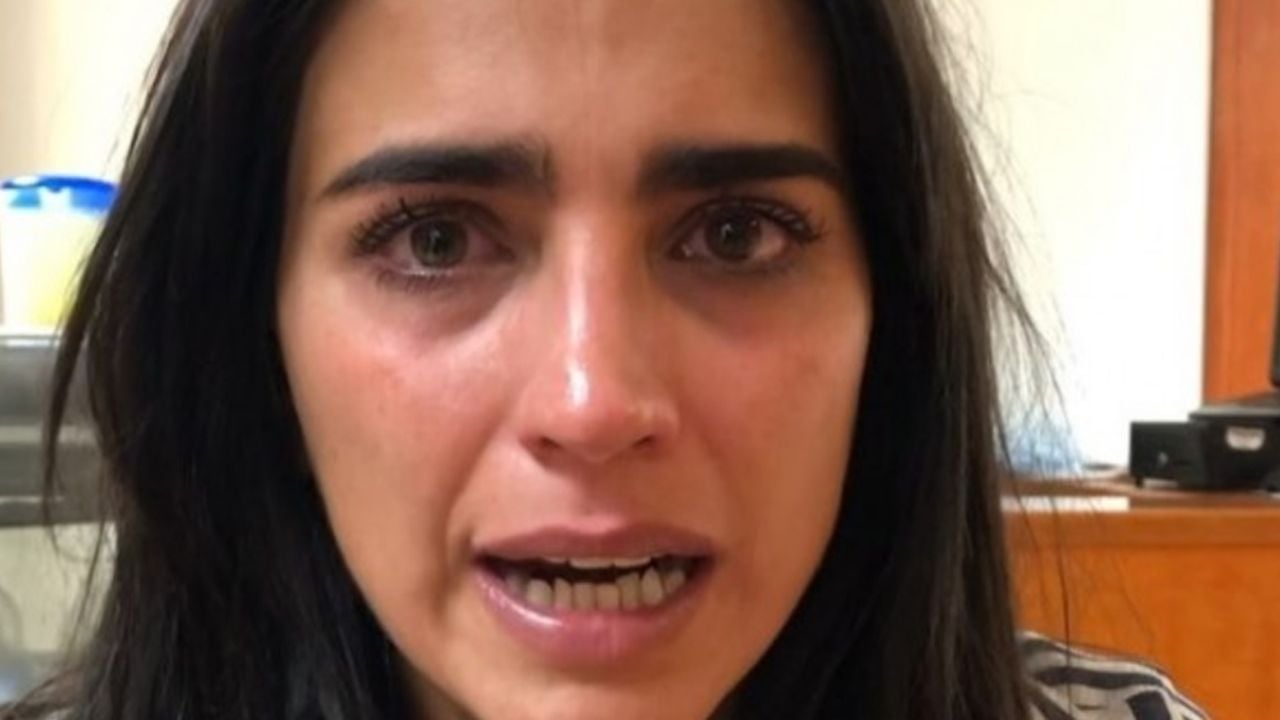 ¡Se quemó la cara! Bárbara de Regil sufre terrible accidente en su propio hogar