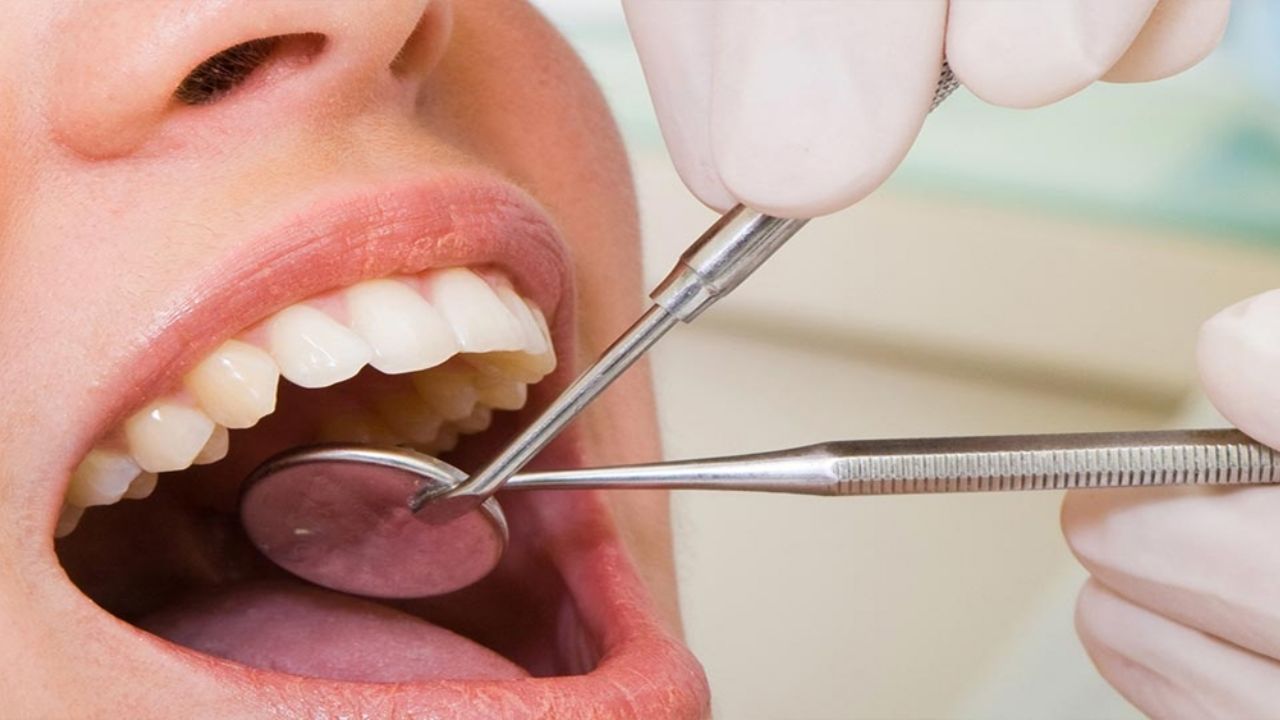 ¡Alarmante! Las caries podrían causar graves problemas, incluso la muerte