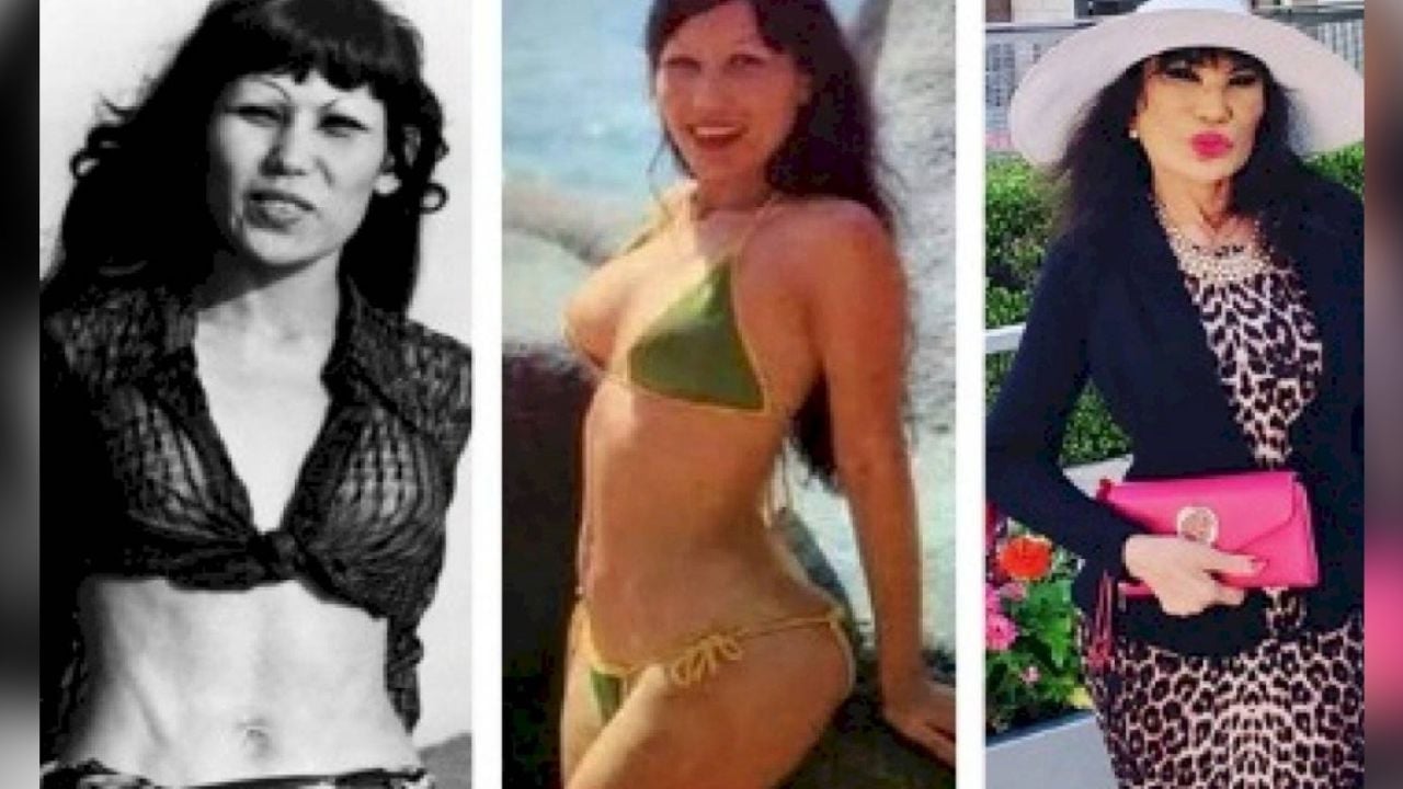 Estos son los 5 famosos que quedaron más ‘desgraciados’ por el cirujano