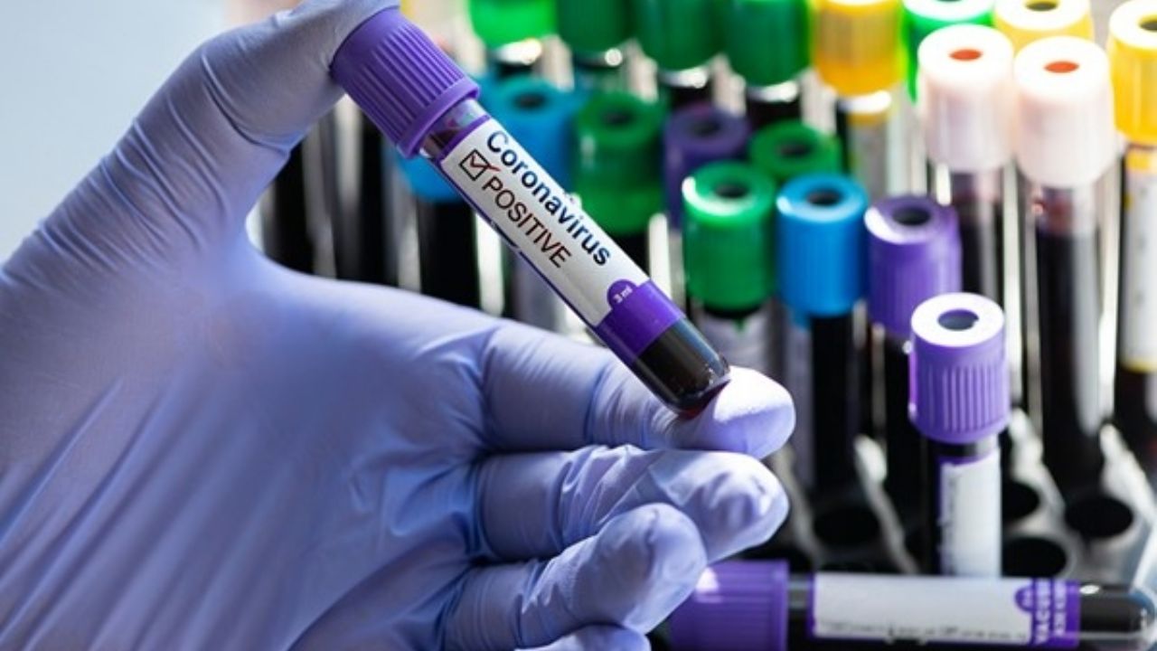 Coronavirus: El mundo contabiliza 2 millones 242 mil 868 casos de Covid-19