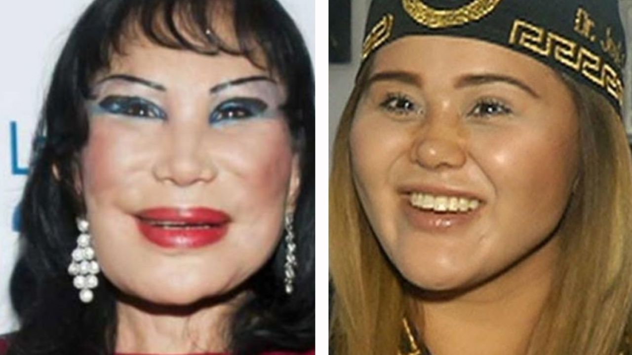 “Está deforme”: Nombran a ‘Gomita’ como “la nueva Lyn May” tras volver a Televisa