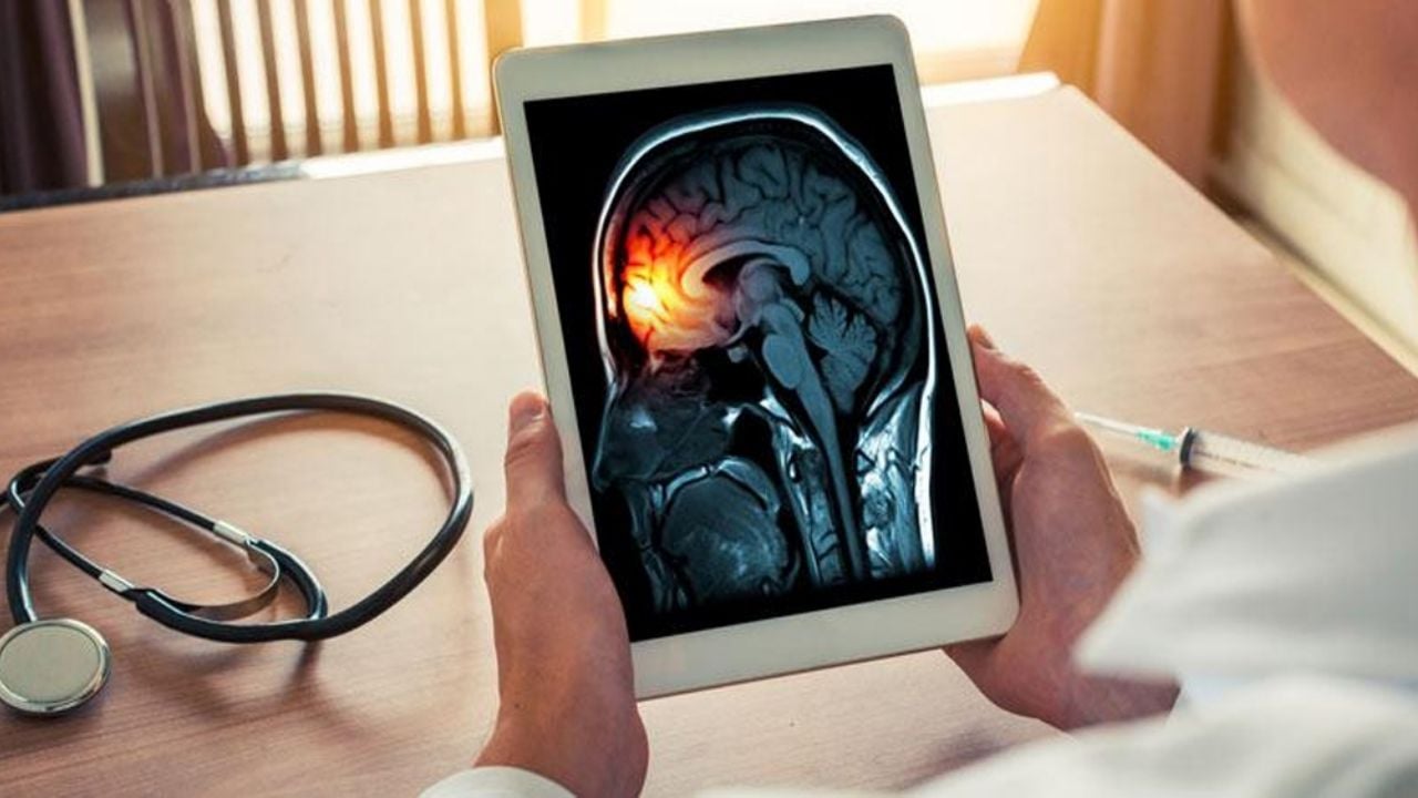 ¿Qué es la meningitis, cuáles son sus síntomas, causas, síntomas y cómo se contagia?