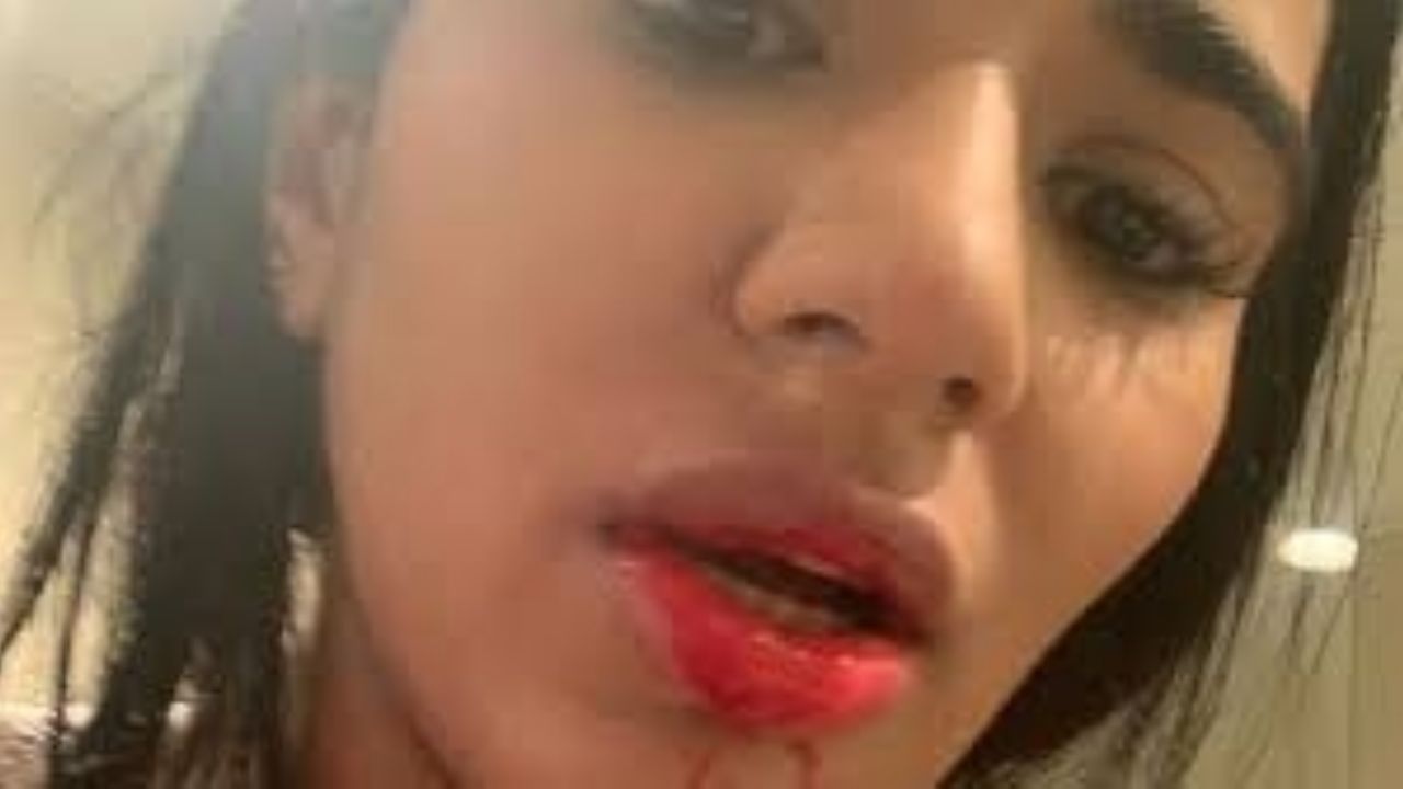 ¡Escándalo! Novia de futbolista colombiano lo denuncia por violencia doméstica