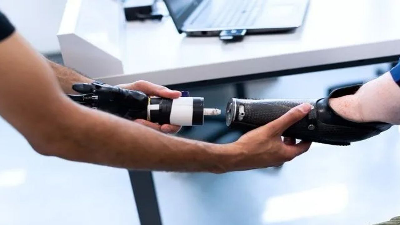 ¡Gracias tecnología! Joven recupera la sensibilidad en las manos con los avance ICC