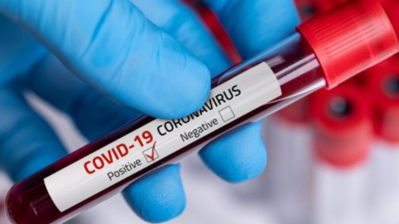 Coronavirus: El mundo contabiliza más de 300 mil muertes por la pandemia