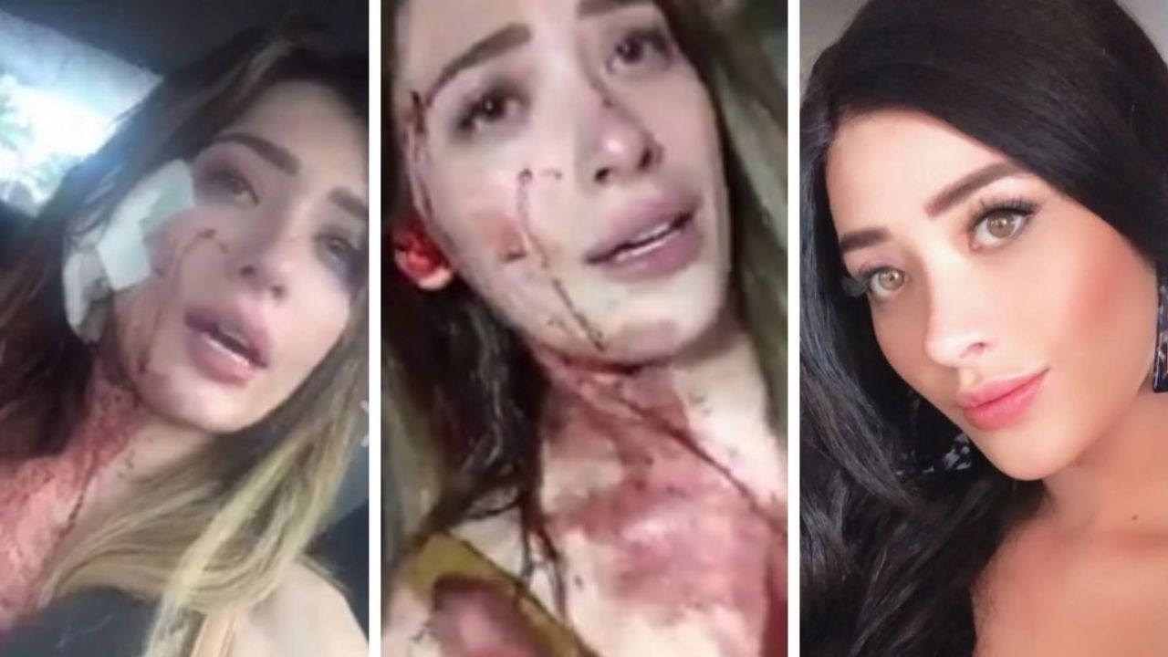 ¡La desfiguró! Brenda Zambrano de ‘Acapulco Shore’ exhibió brutal ataque de mujer: “Vieja pu…”