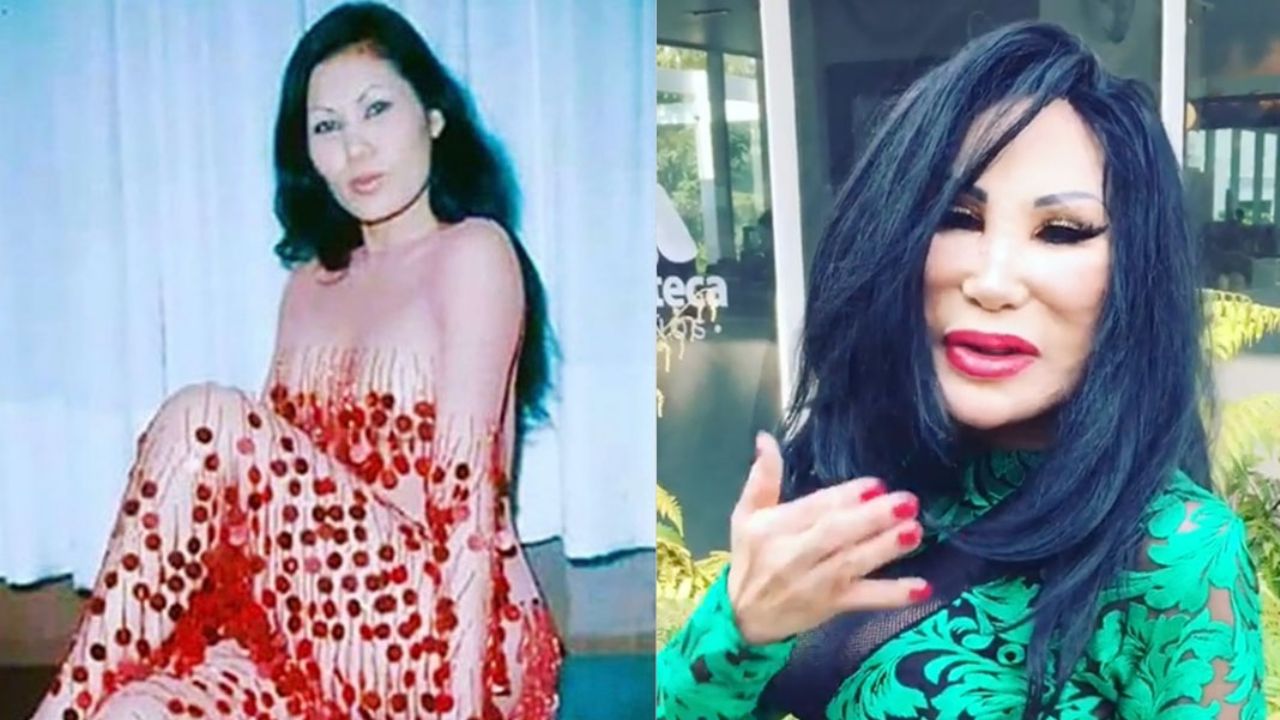 Lyn May causa furor en Instagram al presumir sus curvas antes de ser “desfigurada” por el cirujano