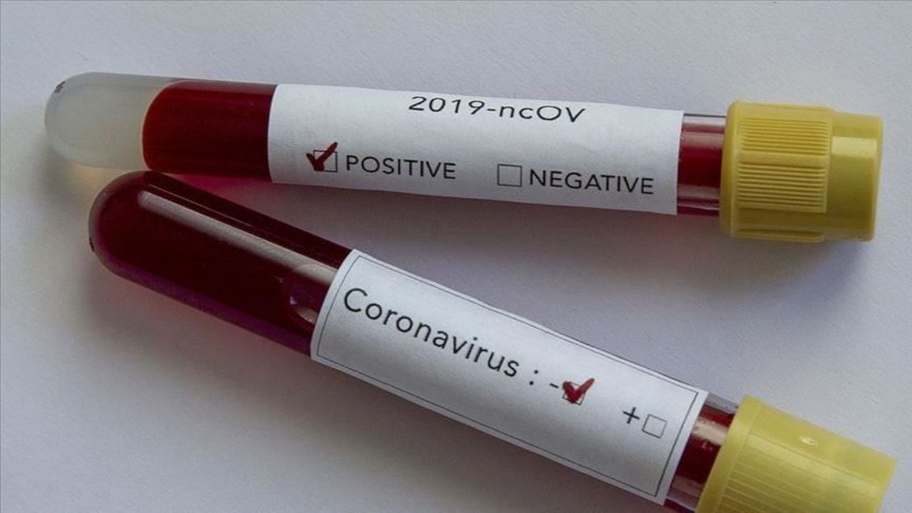 Coronavirus: EU ya supera 1.5 millones de contagios debido a la pandemia