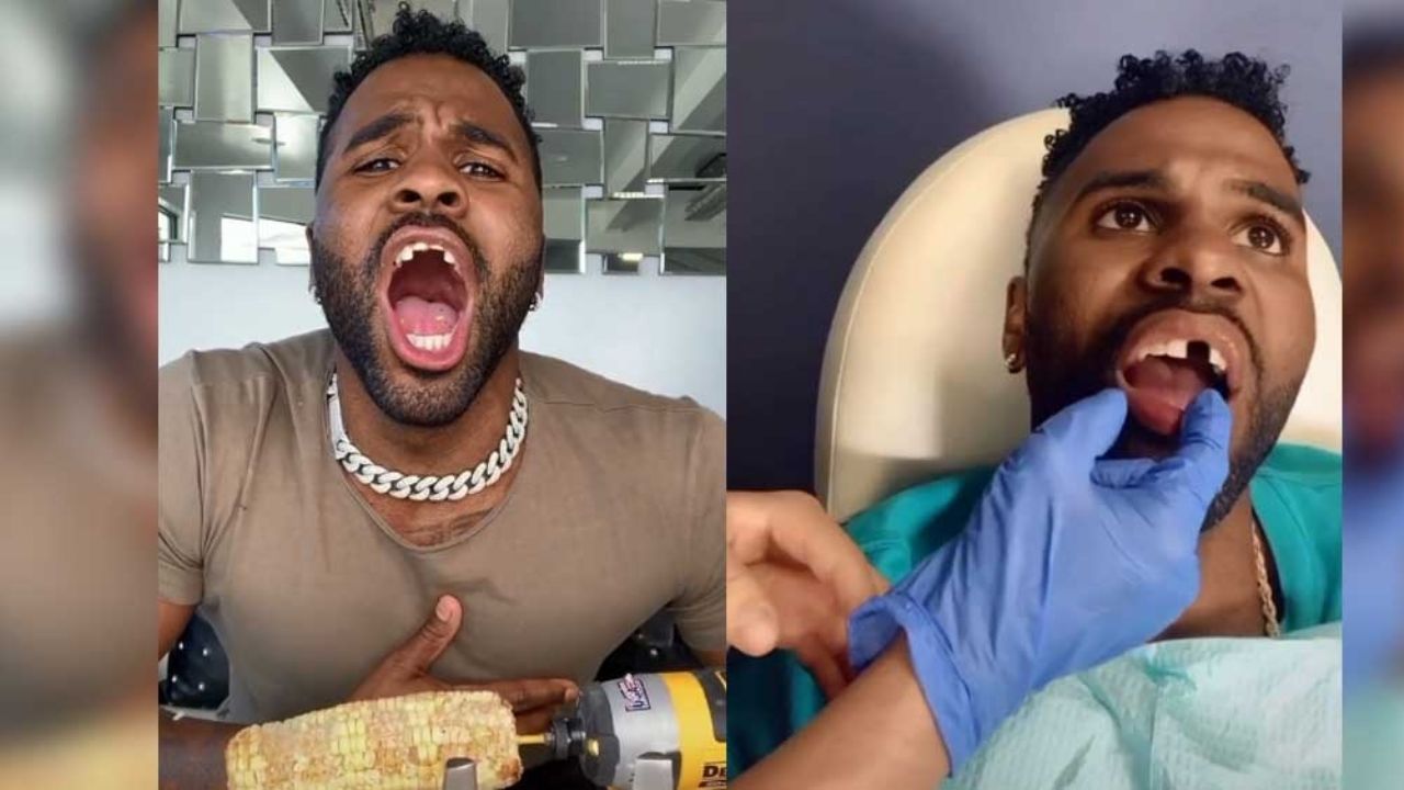 VIDEO: Jason Derulo vuelve a romperse los dientes por hacer reto de TikTok