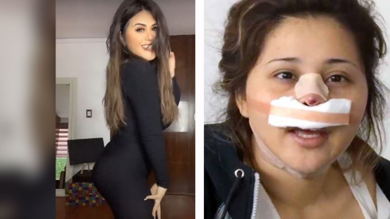 ¿Otro arreglito? Destrozan a ‘Gomita’ en TikTok por ‘deformidad’: “Peor que Lyn May”