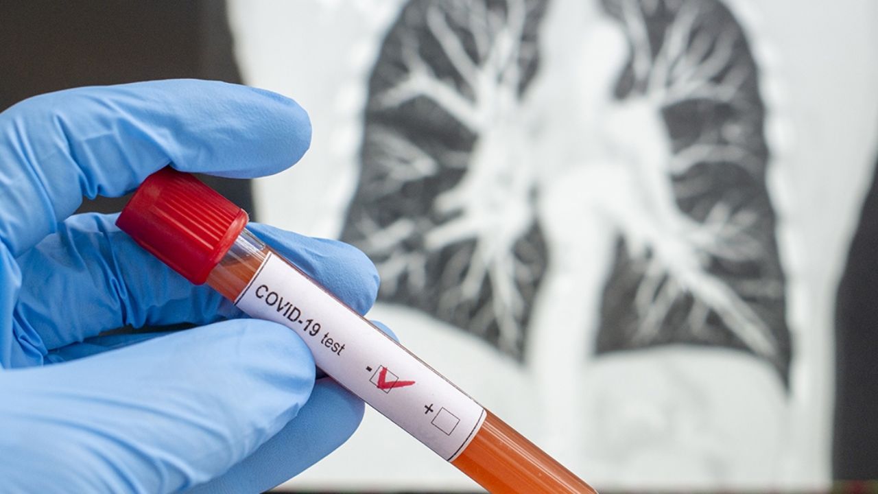 Estudio revela el peligro de asintomáticos con Covid-19: “Pueden contagiar a 400 personas”