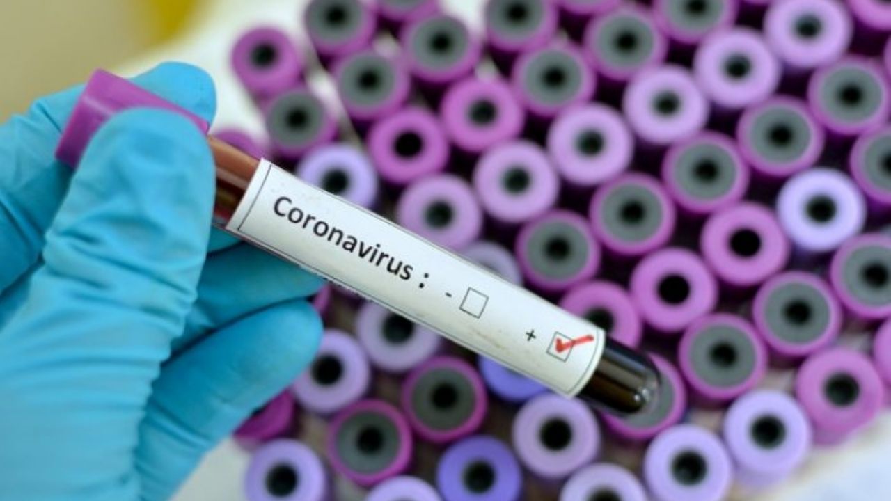 Coronavirus: Se contabilizan más de 350 mil muertos por Covid-19 en el mundo