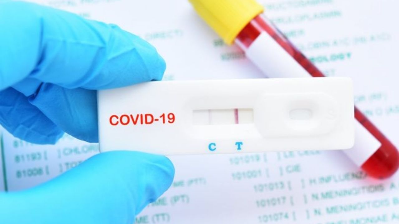 Coronavirus: Latinoamérica ya supera el millón de casos por Covid-19