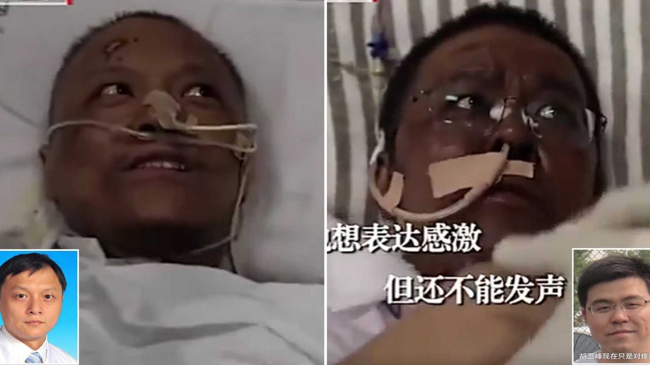 Muere uno de los doctores cuya piel obscureció a causa del Covid-19