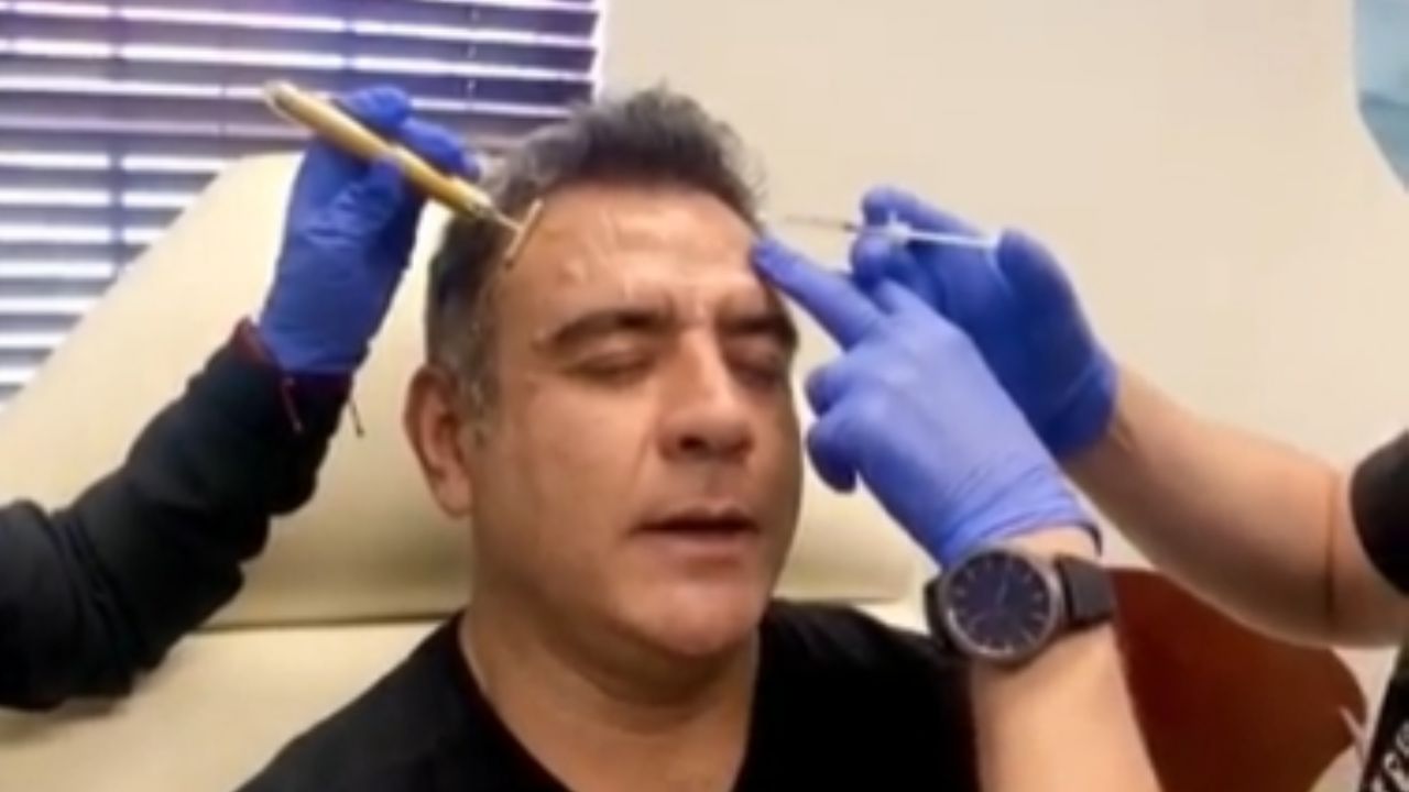 VIDEO: Héctor Sandarti grita de dolor al someterse a inyecciones ¿de bótox?