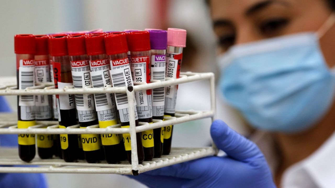 Ayuda Covid-19: Israel usa “vacuna pasiva” desarrollada de pacientes recuperados