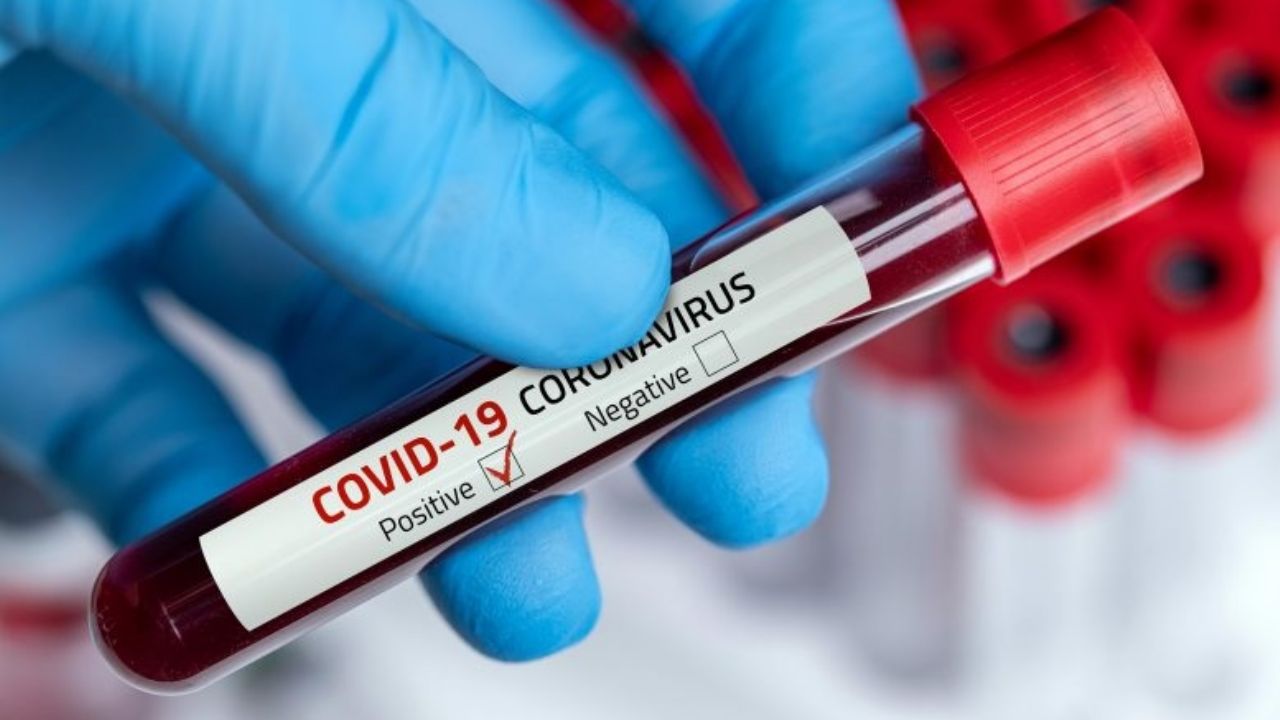 Coronavirus: OMS registra 10.11 millones de casos de Covid-19 en el mundo