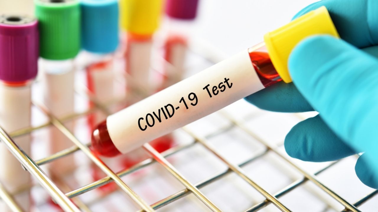 Coronavirus: El Covid-19 ya afecta a 10.32 millones de personas en el mundo