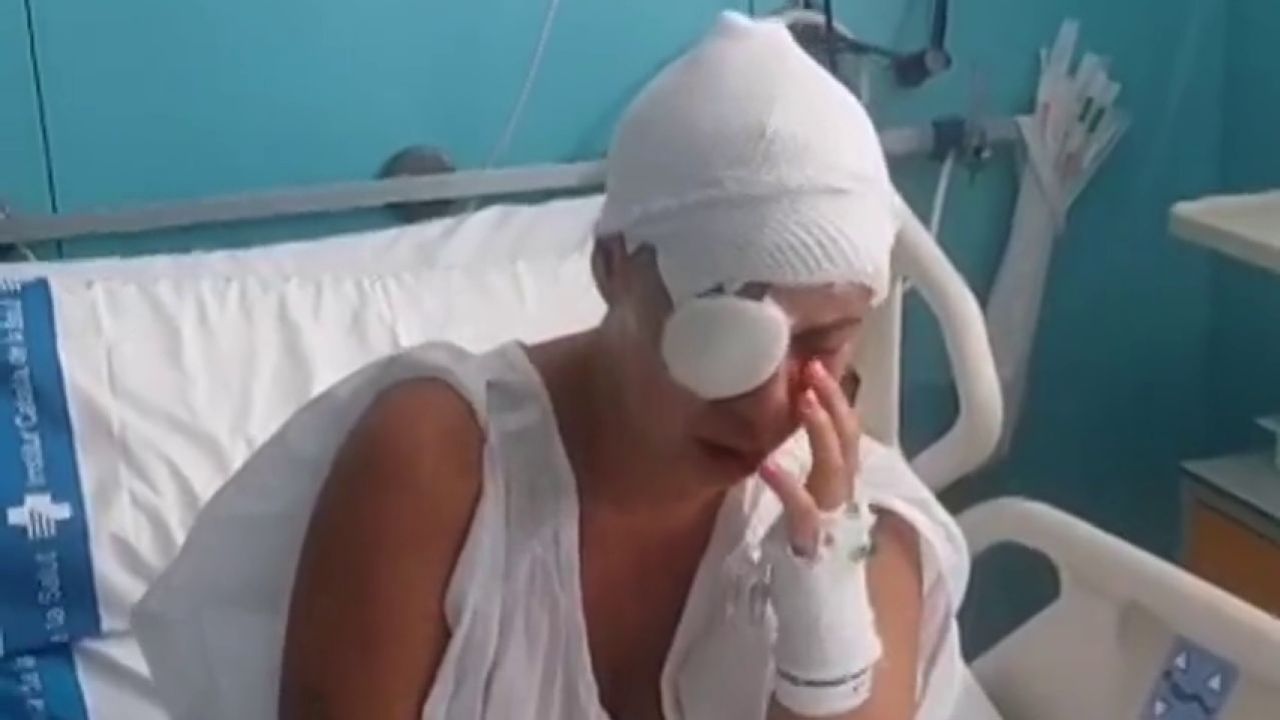 Madre y su hija de 5 años son atacadas con soda caústica en España; sufren quemaduras graves