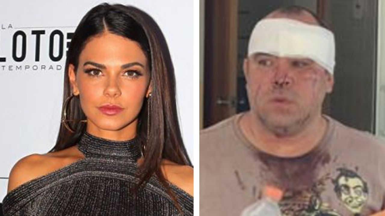 Ni tan arrepentida: Livia Brito contrademandará al paparazzi que golpeó y robó