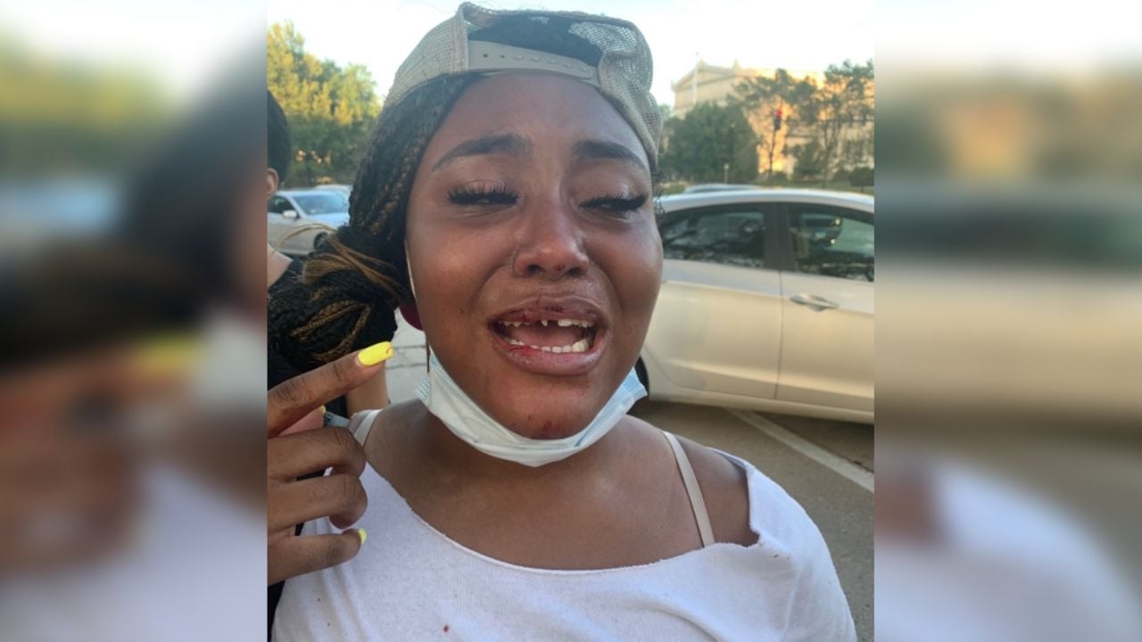 VIDEO: Policía de EU le tira varios dientes a una joven tras darle un puñetazo en la cara