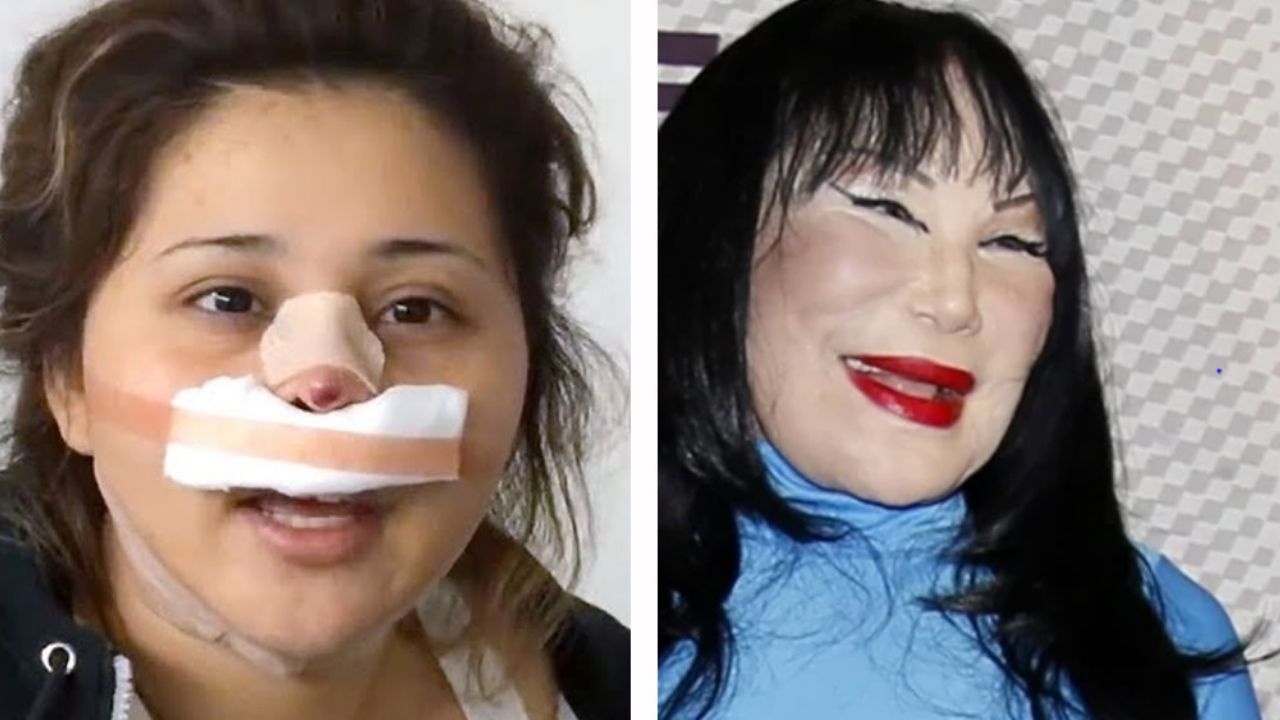 “Lyn May recargada”: ‘Gomita’ se hace nuevo ‘arreglito’ en el rostro y así luce ahora