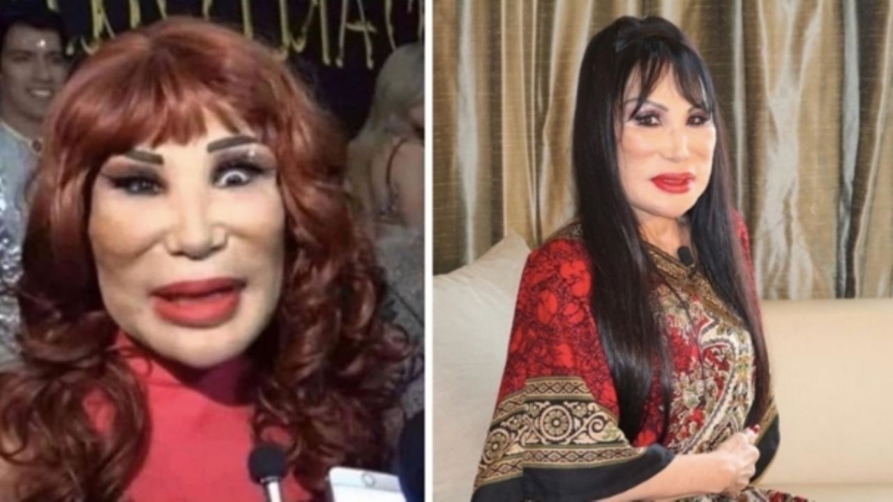 Lyn May impacta al mostrar lo espectacular que lucía antes de que el cirujano la “deformara”