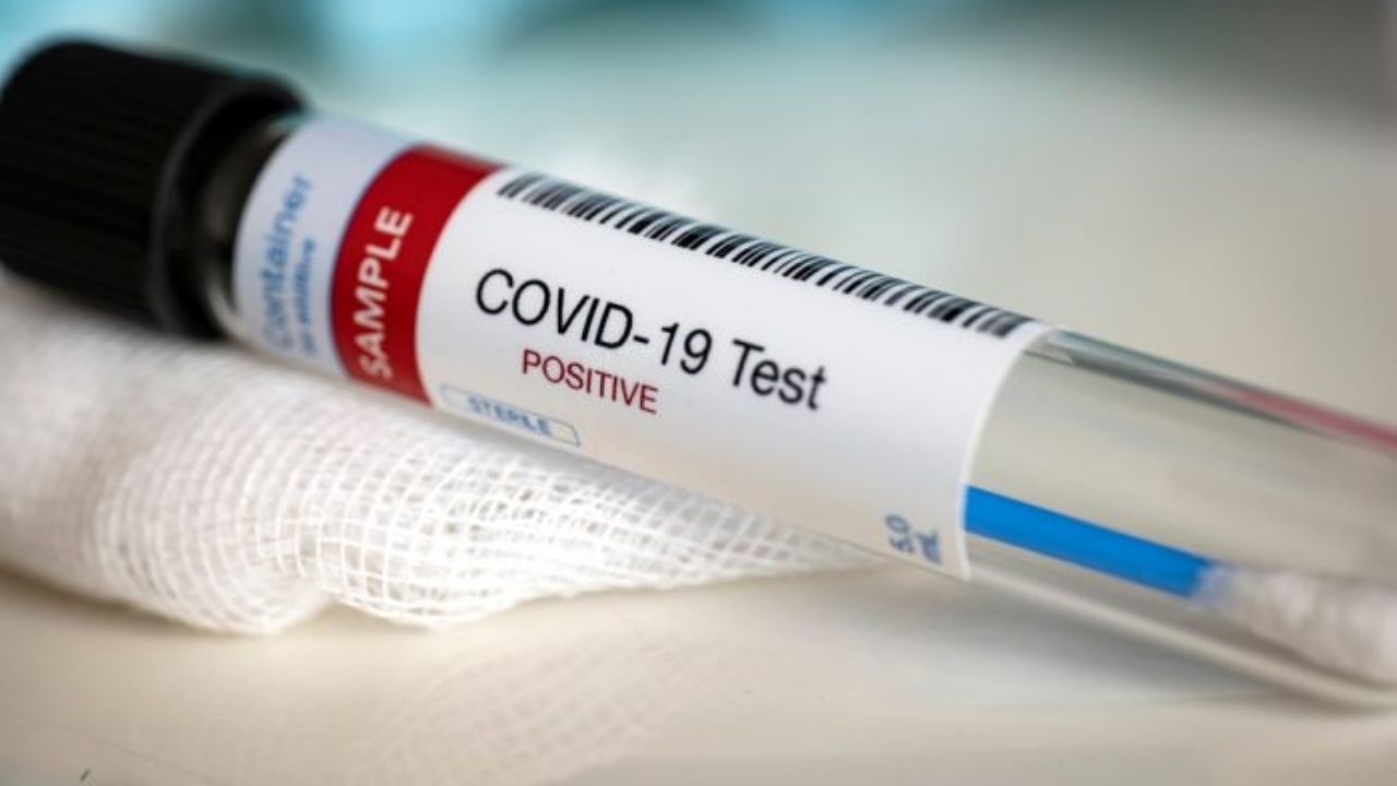 Coronavirus: Se registran más de 17 millones de casos positivos a nivel mundial
