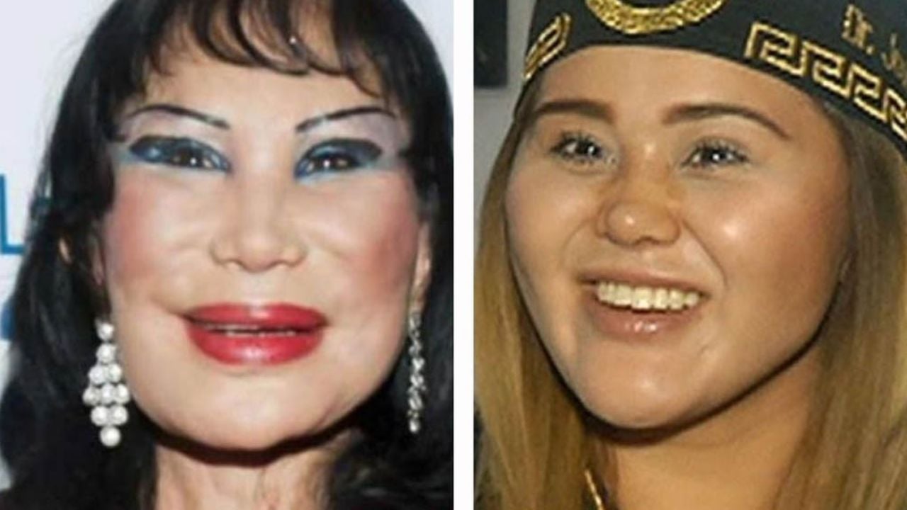Lyn May responde a quienes la comparan con Gomita por sus múltiples cirugías