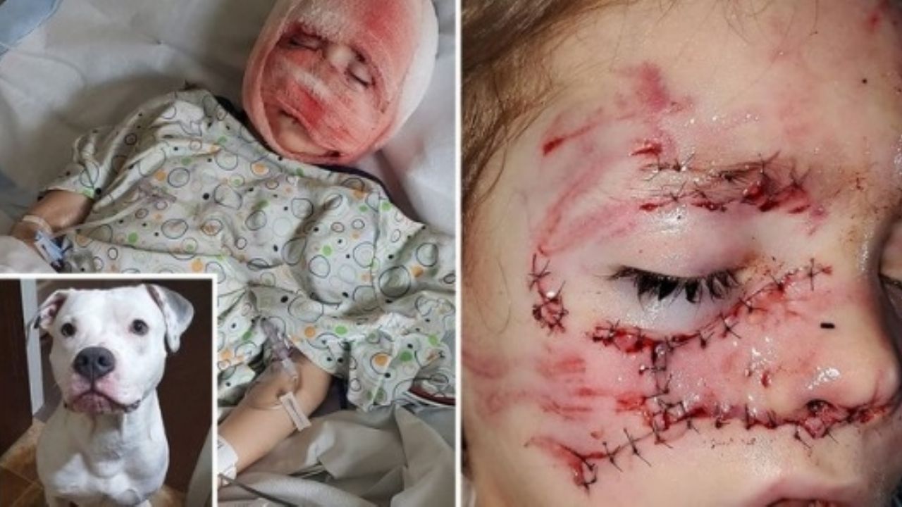 El brutal ataque de su mascota, casi le cuesta la vida a un niño de 6 años