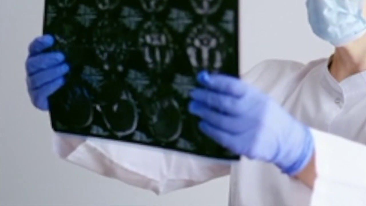 ¡Insólito! Hallan una bala alojada en el cerebro de un niño de 9 años en Israel