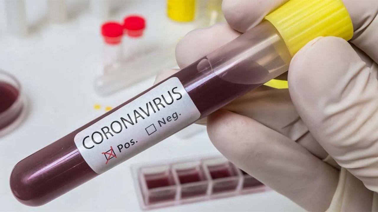 Coronavirus: Ya se contabilizan más de 19 millones de casos a nivel mundial