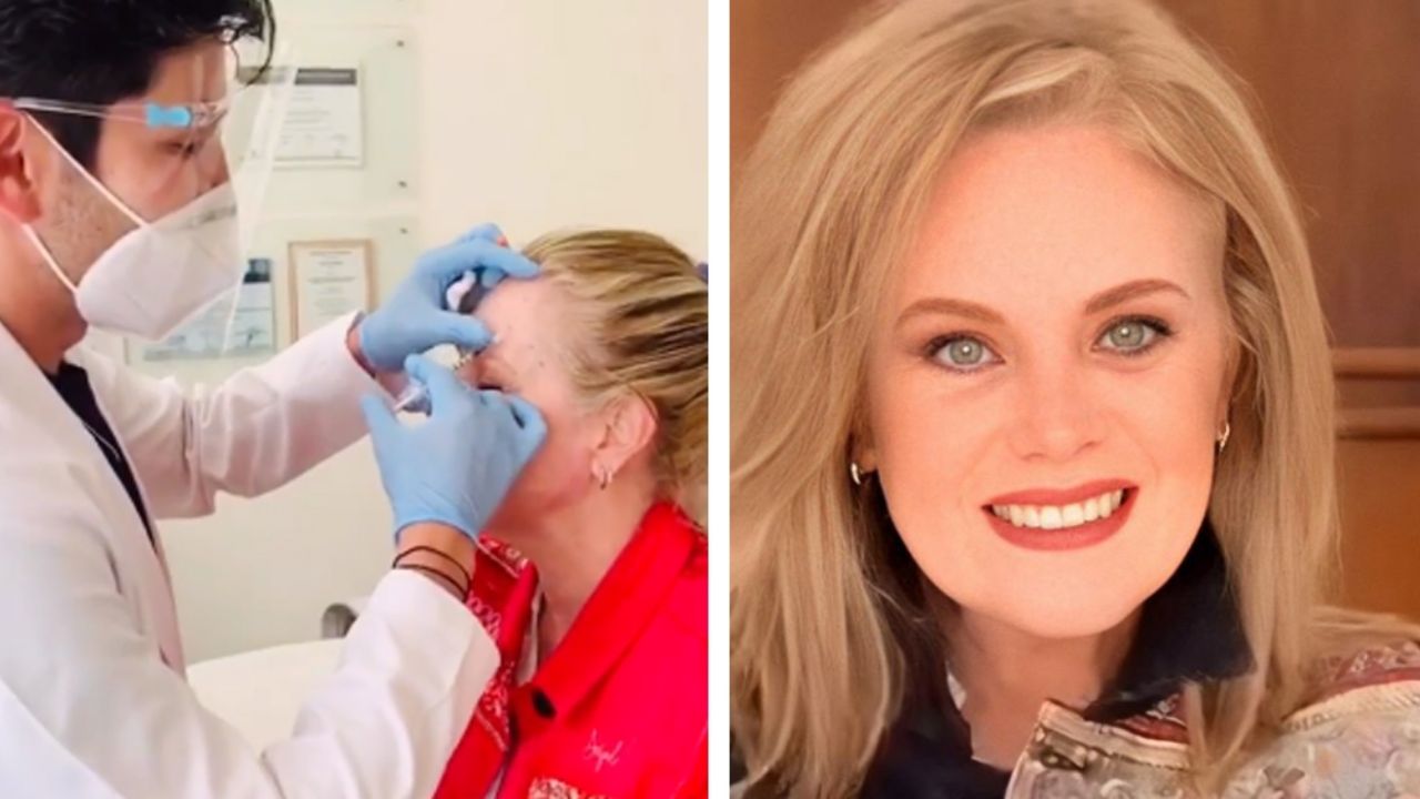 ¿Le pegó la edad? Érika Buenfil se inyecta bótox en la cara y lo muestra en Instagram