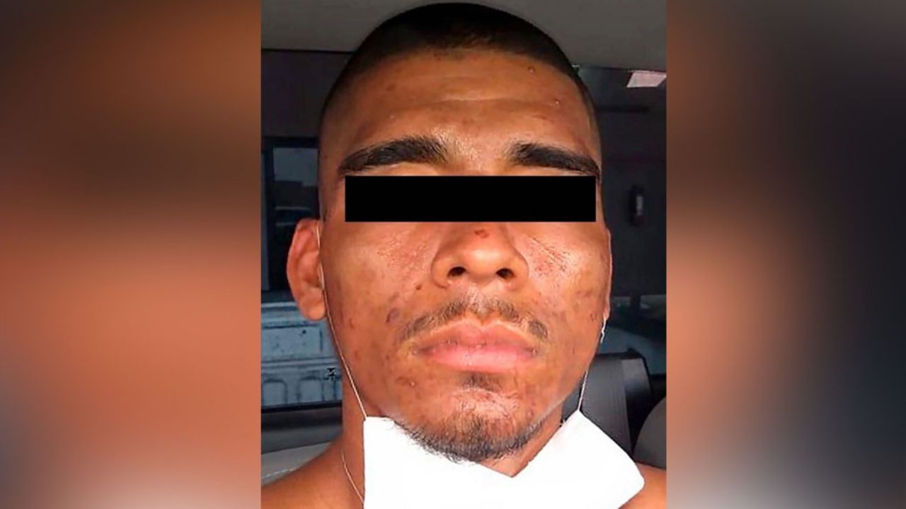 AMIC aprehende a un sujeto que agredió de muerte con un machete a ‘El Rachas’, un perro criollo