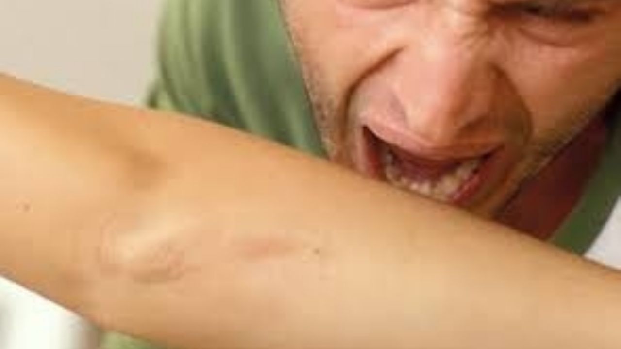 ¡De locos! Comensales muerden a mesero por pedirles que usen cubrebocas