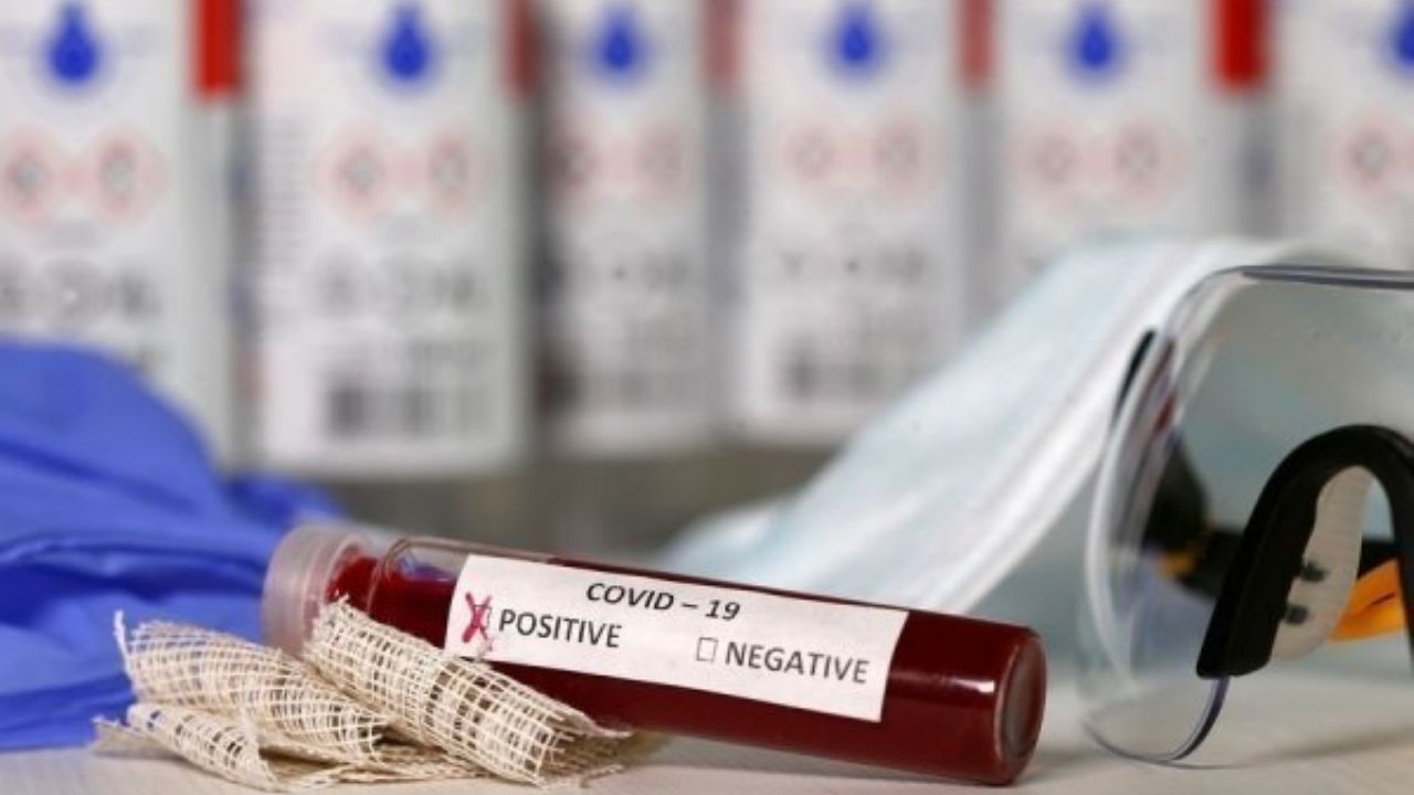 Suecia: 3 mil 700 pruebas de Covid-19 han arrojado resultados con falsos positivos