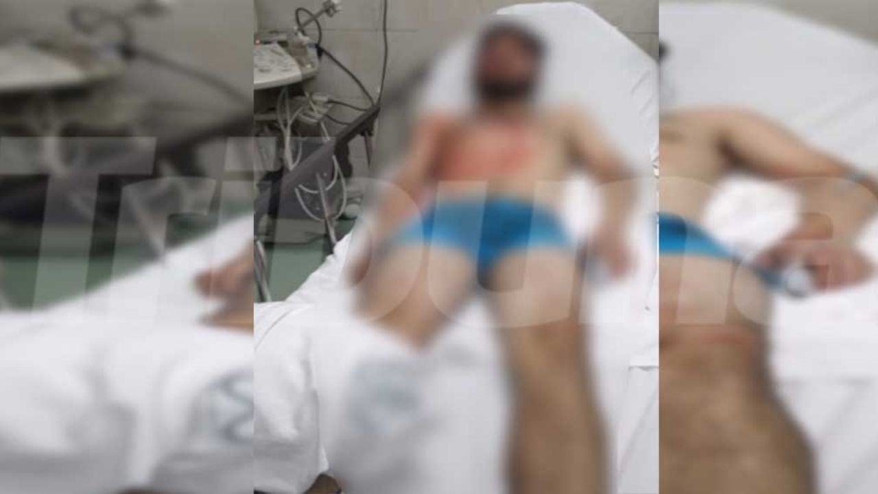 Obregón: Joven resulta lesionado tras ataque armado en fraccionamiento Los Héroes