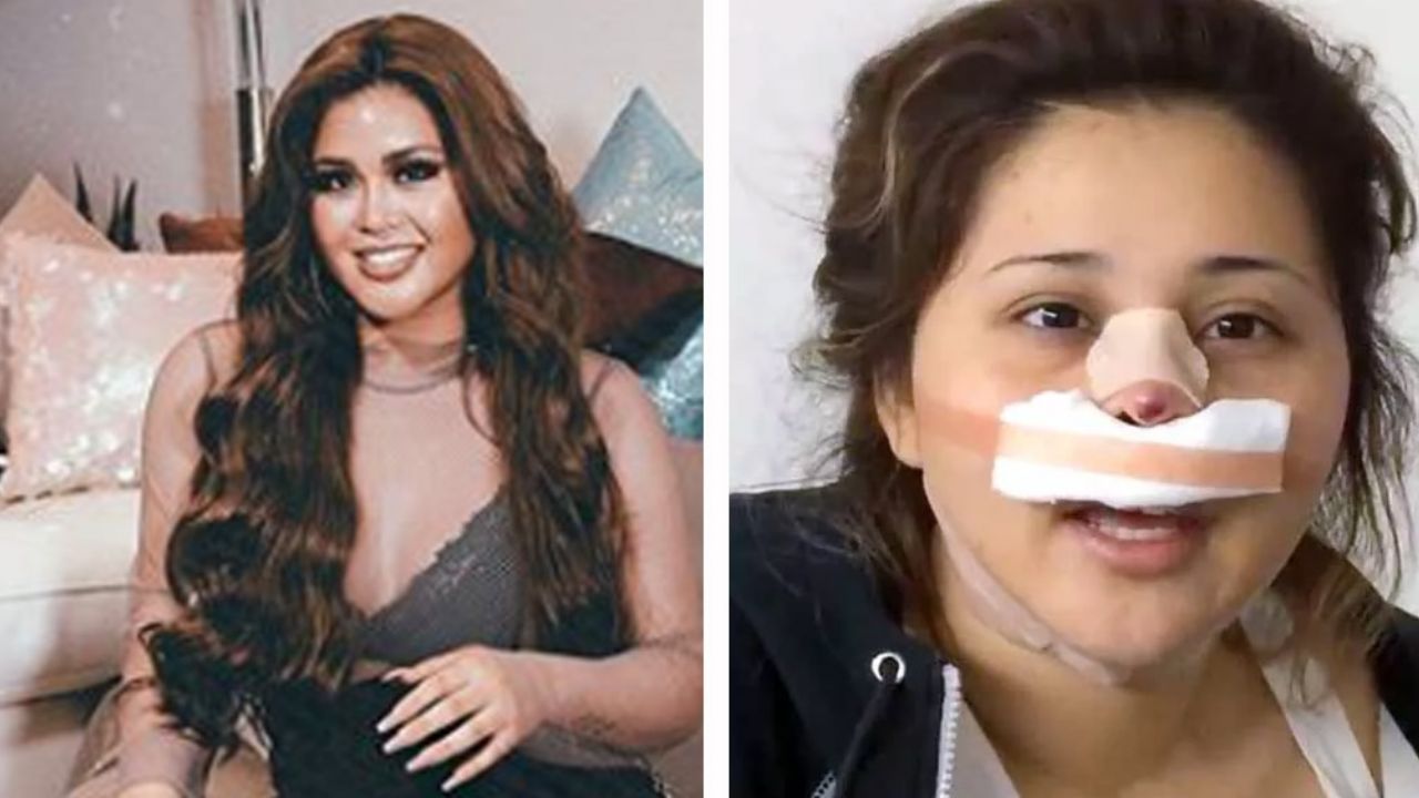 “Pareces guasón”: Se comen viva a ‘Gomita’ en Instagram por “operada y falsa”