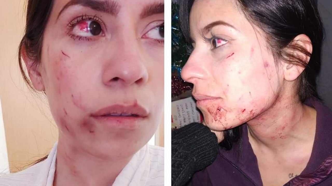 Policía de Coahuila y su esposa propinan brutal golpiza a mujer frente a sus hijos