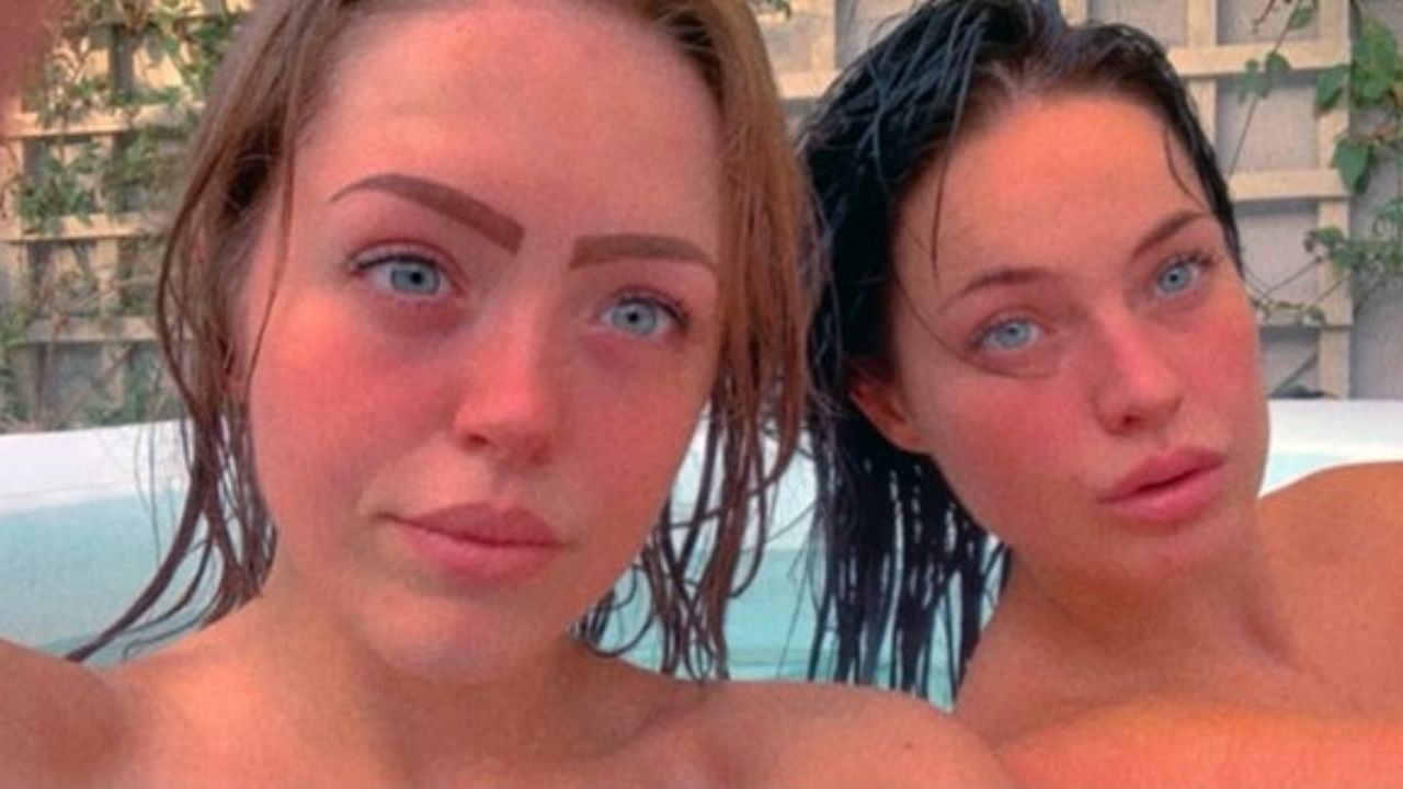 Amputan una pierna a joven de 25 años tras contraer una peligrosa infección en un jacuzzi