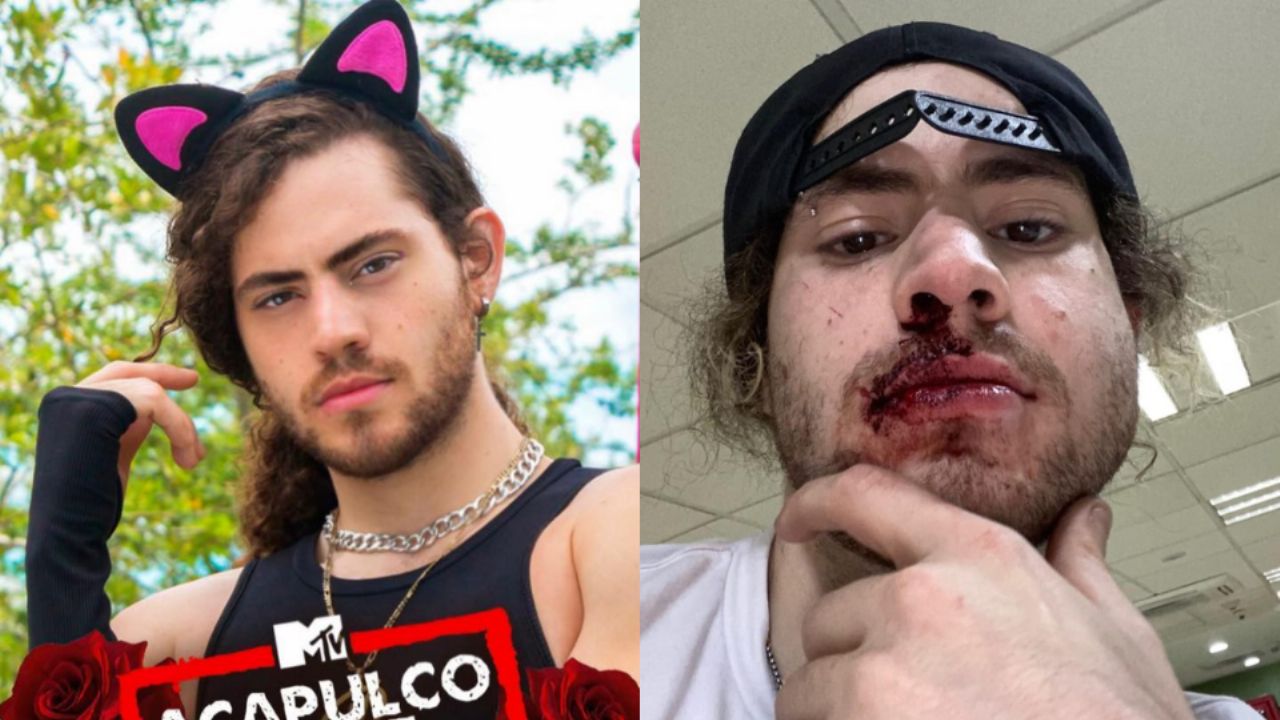 Ricky Ochoa de ‘Acapulco Shore’ termina brutalmente golpeado por guardias de antro