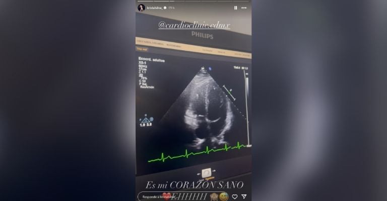 Kristal Silva presume ultrasonido y da inesperada noticia
